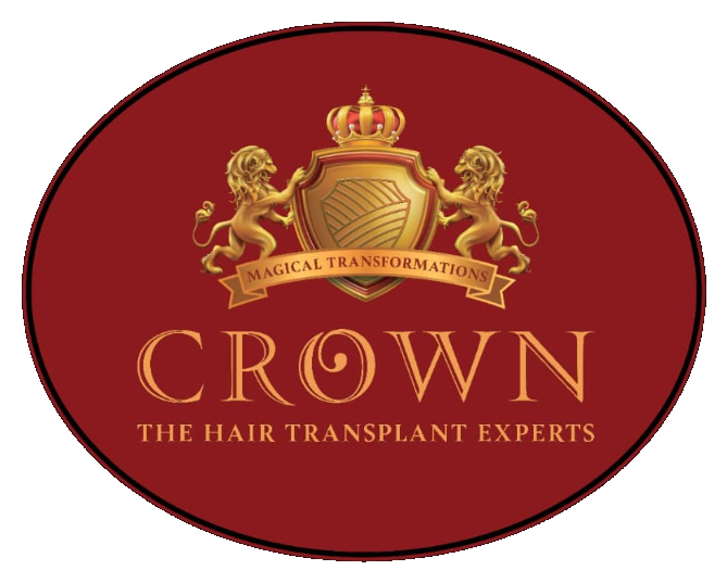 Crown Hair Transplant